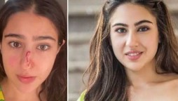 Sara Ali Khan nose injury