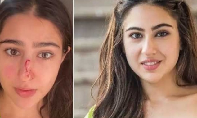 Sara Ali Khan opens up about her nose injury in a video