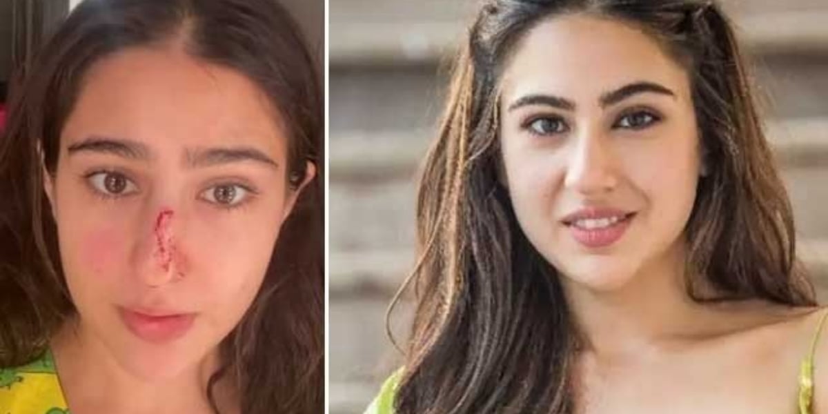 Sara Ali Khan nose injury
