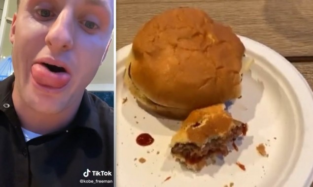 Young man gets stung by bee while eating hamburger
