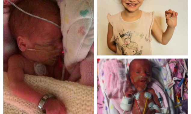 Premature baby who wore dad’s wedding ring as a bracelet