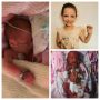 Premature baby who wore dad’s wedding ring as a bracelet