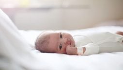 Newborn baby grows dense thick hair all over her body