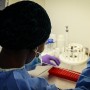 Meningitis outbreak kills 129 people in Congo: WHO