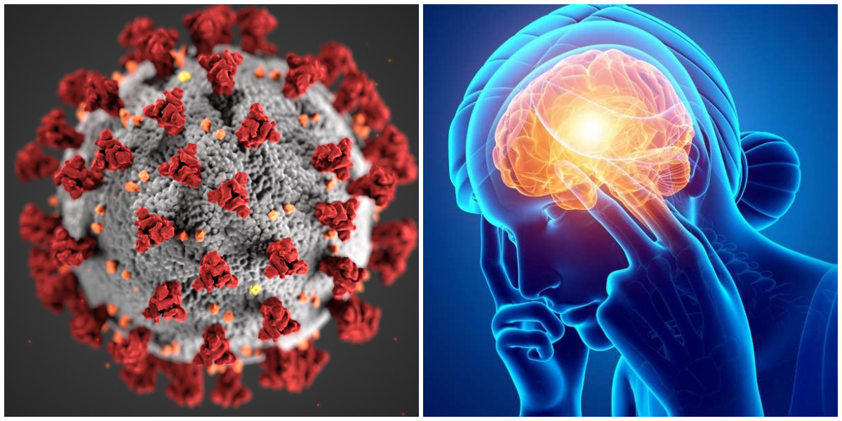 Decline in brain age observed among hospitalized COVID-19 patients: Research