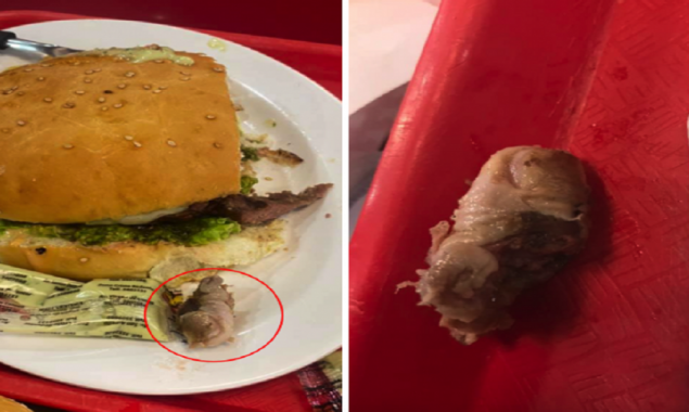 Customer shocked! After noticing the rotten finger in hamburger