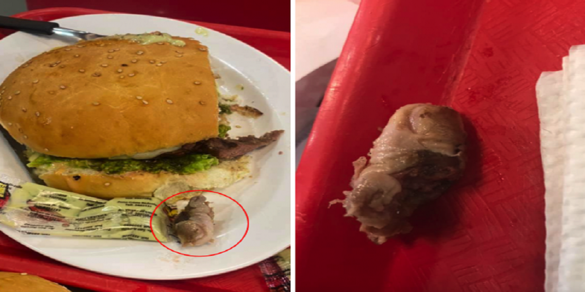 Customer shocked! After noticing the rotten finger in hamburger
