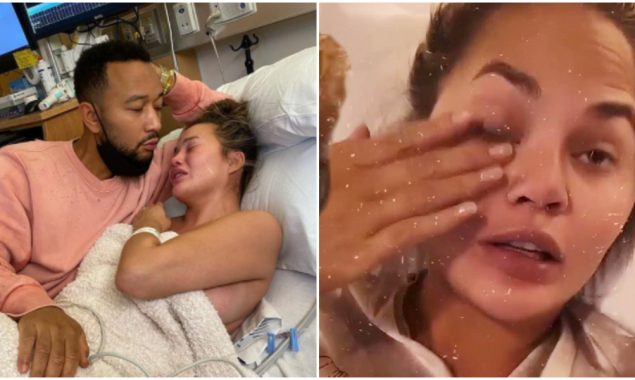Chrissy Teigen claims she felt “suctioned to the couch” after losing her pregnancy