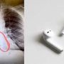 A young man swallowed the AirPods down his throat while sleeping
