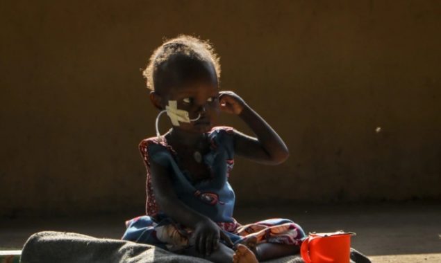 Sharp jump in number of people facing famine: UN