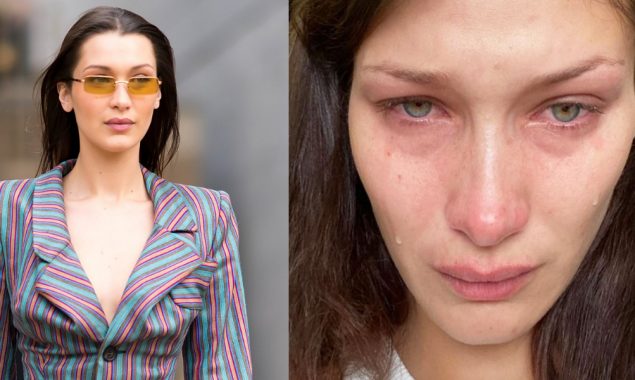 Bella Hadid opens up about mental health issues & anxiety