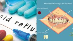 Study: shows heartburn drugs may help in improving gum disease