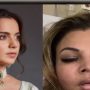 Rakhi Sawant says she fell sick after hearing Kangana Ranaut’s comments