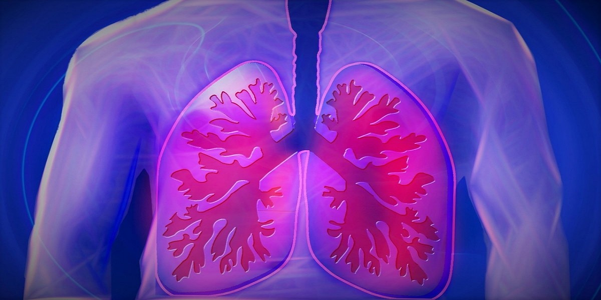 Survival rates of lung cancer are improved but not for the racial group