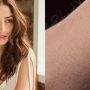 Yami Gautam reveals people’s reaction to her skin condition
