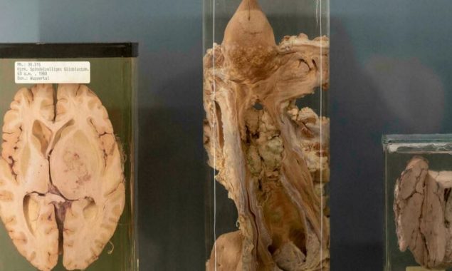 Vienna exhibition tests ethics of displaying human remains
