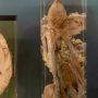 Vienna exhibition tests ethics of displaying human remains