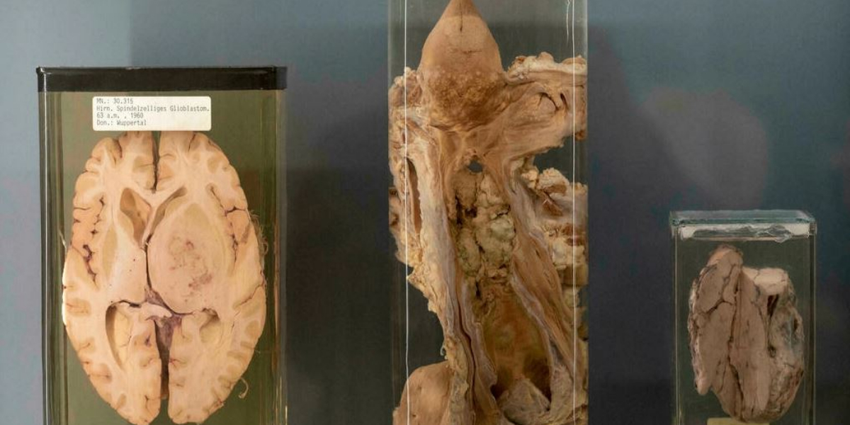 Vienna exhibition tests ethics of displaying human remains