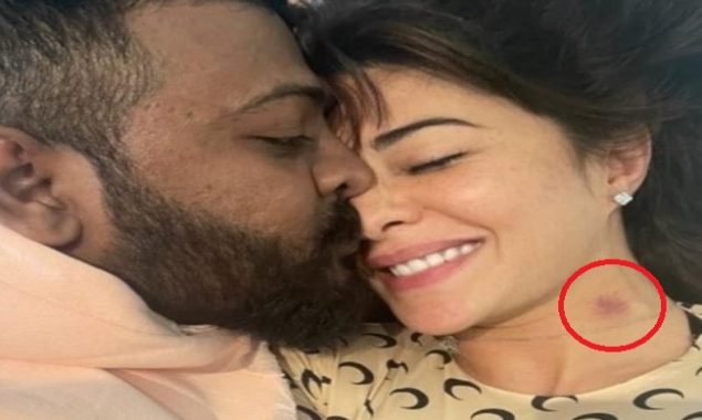 Jacqueline Fernandez flaunts love bite on neck in leaked picture with Suresh Chandrasekhar