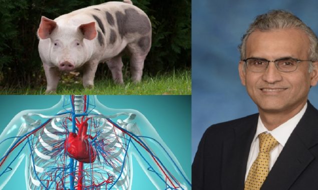 Pakistani doctor made history by transplanting a pig’s heart into a Human