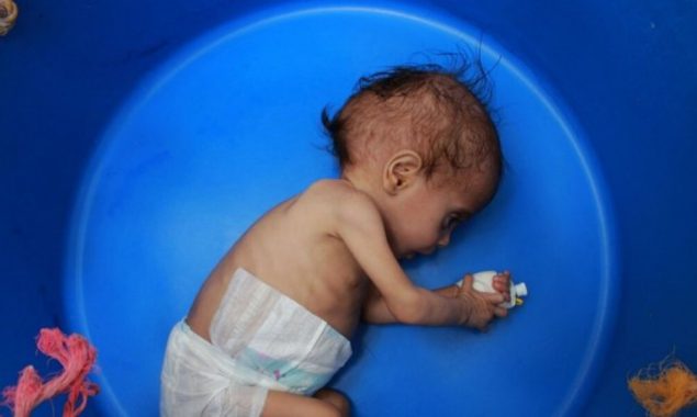 yemen aid