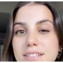 I had Botox and can now hardly open one of my eyes