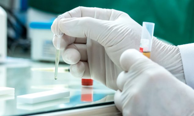 Random COVID-19 testing kicks off in North Macedonia