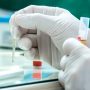 Random COVID-19 testing kicks off in North Macedonia