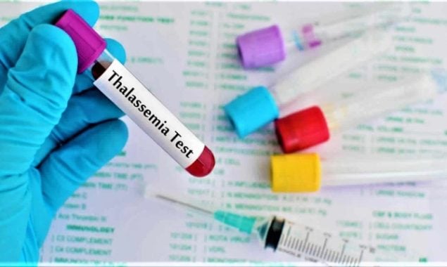 Punjab soon to have pre-marriage thalassemia test, says health minister