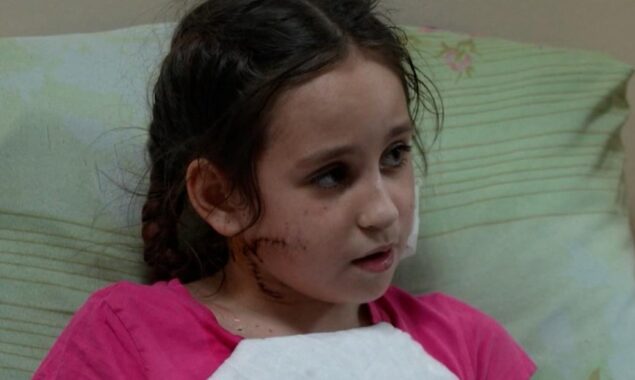 Russian soldier shoots 11-year-old Ukranian girl in the face