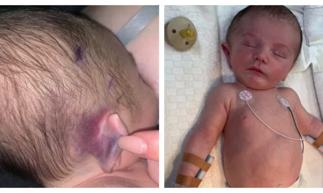 I’m sharing heartbreaking photos of my baby boy so that no other parents have to go through what we did