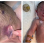 I’m sharing heartbreaking photos of my baby boy so that no other parents have to go through what we did
