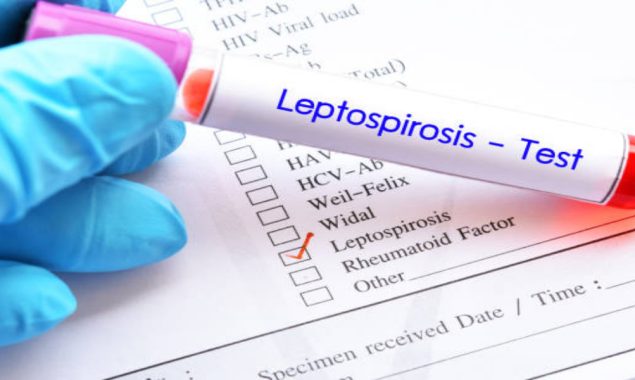 29 people die of leptospirosis in Fiji