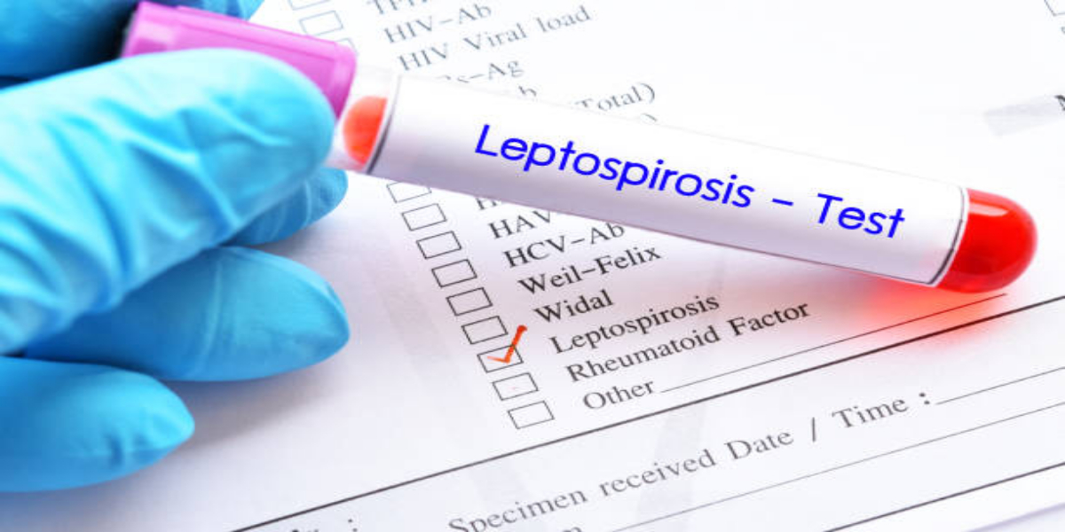 leptospirosis