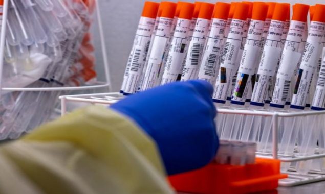 New Zealand reports 22,152 new community cases of COVID-19