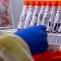 New Zealand reports 22,152 new community cases of COVID-19