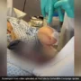 After a battle with sepsis, a woman in the United Kingdom was left with a ‘Shark Hand.’