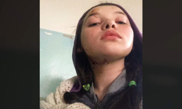 A 12-year-old Ukrainian girl is recruited into Moscow’s information war despite being injured, alone, and headed for a Russian orphanage