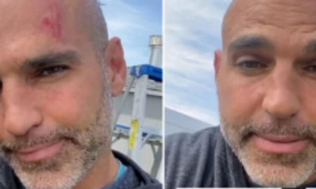 Watch Video: Joe Gorga shows off bloody head injury from ladder fall