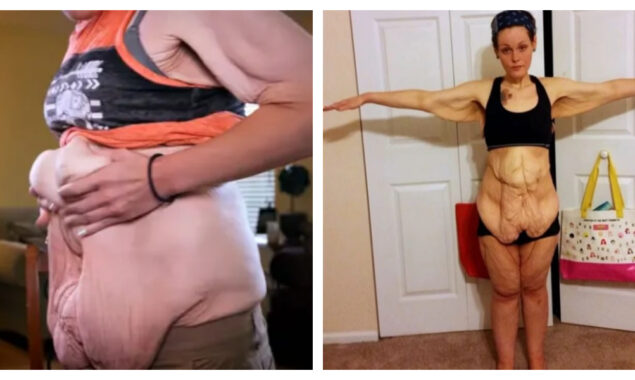 I shed 24 stone to make my children proud, but I now despise the way my body looks — I can’t stomach looking at myself