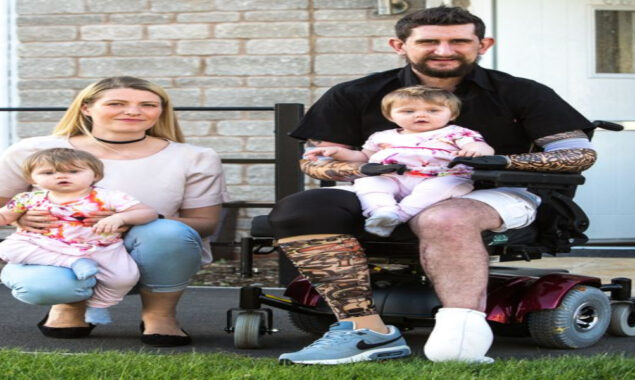 Tradies arms amputated after shock