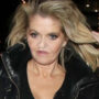 Watch: Danniella Westbrook shows results of surgery after ‘rib inserted’ in her face