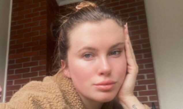 Ireland Baldwin Says She Opted for facetite to get rid of very Stubborn Pocket of Fat