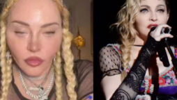 Plastic surgeon points out ‘lots of issues’ on Madonna’s face