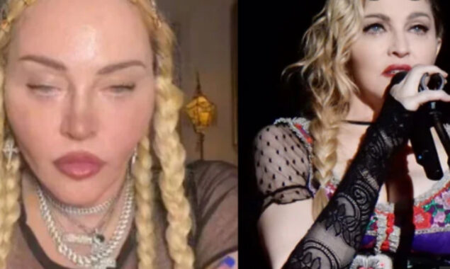 Plastic surgeon points out ‘lots of issues’ on Madonna’s face