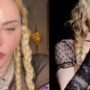 Plastic surgeon points out ‘lots of issues’ on Madonna’s face