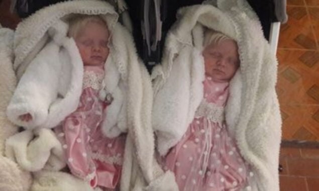 A woman gives birth to twins with snow-white hair in Argentina