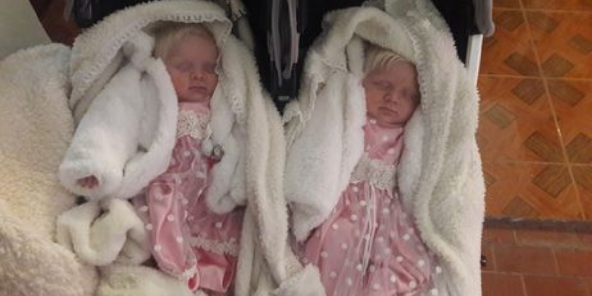 A woman gives birth to twins with snow-white hair in Argentina