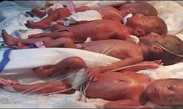 The World-record holder nonuplets celebrate first birthday