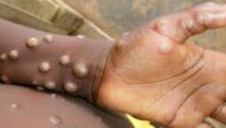 Belgium is first country to impose strict monkeypox quarantine as global cases rise